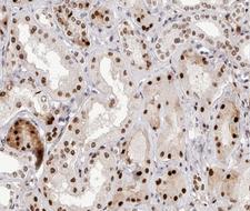 NFKB2 Antibody - 1:200 staining human kidney tissue by IHC-P. The tissue was formaldehyde fixed and a heat mediated antigen retrieval step in citrate buffer was performed. The tissue was then blocked and incubated with the antibody for 1.5 hours at 22°C. An HRP conjugated goat anti-rabbit antibody was used as the secondary.