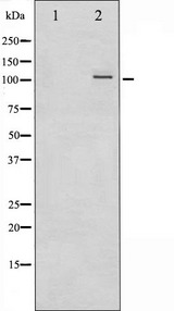 NFKB2 Antibody - Western blot analysis of NF-kappaB p100/p52 phosphorylation expression in ovary carcinoma whole cells lysates. The lane on the left is treated with the antigen-specific peptide.