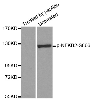 NFKB2 Antibody - Western blot analysis of extracts from ovary cancer cells.