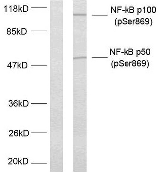 NFKB2 Antibody - Western blot analysis of lysates from MDA-MB-435 cells treated with TNF-alpha, using NF-kappaB p100/p52 (Phospho-Ser869) Antibody. The lane on the left is blocked with the phospho peptide.