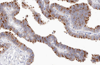 NFKB2 Antibody - 1:200 staining human Fallopian tube tissue by IHC-P. The tissue was formaldehyde fixed and a heat mediated antigen retrieval step in citrate buffer was performed. The tissue was then blocked and incubated with the antibody for 1.5 hours at 22°C. An HRP conjugated goat anti-rabbit antibody was used as the secondary.