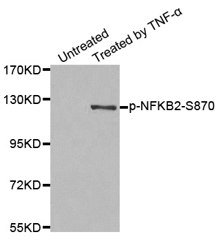 NFKB2 Antibody - Western blot analysis of extract from MDA-MB-435 cells.