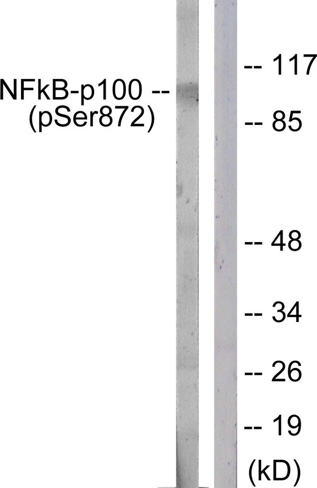 NFKB2 Antibody - Western blot analysis of lysates from RAW264.7 cells treated with EGF 200ng/ml 30', using NF-kappaB p100 (Phospho-Ser872) Antibody. The lane on the right is blocked with the phospho peptide.