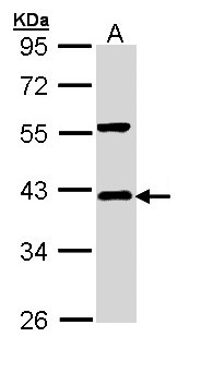 NFKBIA / IKB Alpha / IKBA Antibody - Sample (30 ug of whole cell lysate). A: Hep G2 . 10% SDS PAGE. IKB Alpha / IKBA antibody diluted at 1:1000.