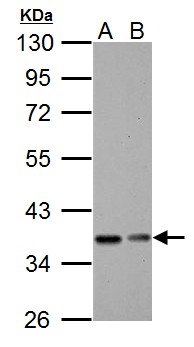 NFKBIA / IKB Alpha / IKBA Antibody - IKB alpha antibody detects IKB alpha protein by Western blot analysis. A. 30 ug BCL-1 whole cell lysate/extract. B. 30 ug C2C12 whole cell lysate/extract. 10 % SDS-PAGE. IKB alpha antibody dilution:1:5000