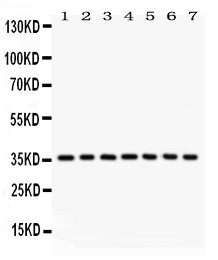 NFKBIA / IKB Alpha / IKBA Antibody - IKB alpha antibody Western blot. All lanes: Anti IKB alpha at 0.5 ug/ml. Lane 1: Rat Brain Tissue Lysate at 50 ug. Lane 2: Mouse Brain Tissue Lysate at 50 ug. Lane 3: Rat Kidney Tissue Lysate at 50 ug. Lane 4: Mouse Kidney Tissue Lysate at 50 ug. Lane 5: 293T Whole Cell Lysate at 40 ug. Lane 6: JURKAT Whole Cell Lysate at 40 ug. Lane 7: RAJI Whole Cell Lysate at 40 ug. Predicted band size: 36 kD. Observed band size: 36 kD.