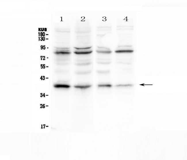 NFKBIA / IKB Alpha / IKBA Antibody - Western blot analysis of IKB Alpha using anti-IKB Alpha antibody. Electrophoresis was performed on a 5-20% SDS-PAGE gel at 70V (Stacking gel) / 90V (Resolving gel) for 2-3 hours. The sample well of each lane was loaded with 50ug of sample under reducing conditions. Lane 1: human Jurkat whole cell lysates, Lane 2: human MDA-MB-453 whole cell lysates, Lane 3: human SW620 whole cell lysates, Lane 4: human A549 whole cell lysates. After Electrophoresis, proteins were transferred to a Nitrocellulose membrane at 150mA for 50-90 minutes. Blocked the membrane with 5% Non-fat Milk/ TBS for 1.5 hour at RT. The membrane was incubated with rabbit anti-IKB Alpha antigen affinity purified polyclonal antibody at 0.5 µg/mL overnight at 4°C, then washed with TBS-0.1% Tween 3 times with 5 minutes each and probed with a goat anti-rabbit IgG-HRP secondary antibody at a dilution of 1:10000 for 1.5 hour at RT. The signal is developed using an Enhanced Chemiluminescent detection (ECL) kit with Tanon 5200 system. A specific band was detected for IKB Alpha at approximately 39KD. The expected band size for IKB Alpha is at 36KD.