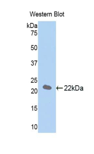 NFKBIA / IKB Alpha / IKBA Antibody - Western blot of recombinant NFKBIA / IKB Alpha / IKBA.  This image was taken for the unconjugated form of this product. Other forms have not been tested.