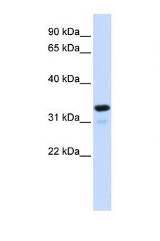 NFKBIA / IKB Alpha / IKBA Antibody - NFKBIA antibody Western blot of 293T Cell lysate. Antibody concentration 1 ug/ml. This image was taken for the unconjugated form of this product. Other forms have not been tested.