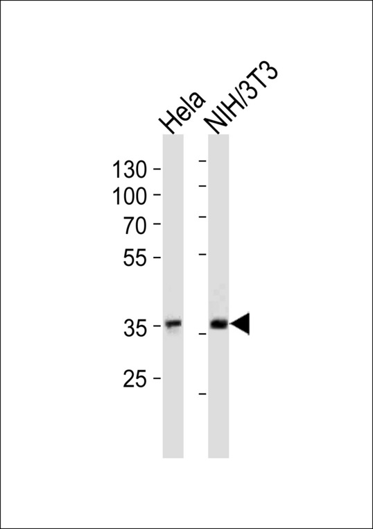 NFKBIA / IKB Alpha / IKBA Antibody - NFKBIA Antibody western blot of HeLa,mouse NIH/3T3 cell line lysates (35 ug/lane). The NFKBIA antibody detected the NFKBIA protein (arrow).