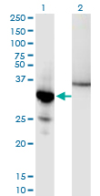 NFKBIA / IKB Alpha / IKBA Antibody - Western Blot analysis of NFKBIA expression in transfected 293T cell line by NFKBIA monoclonal antibody (M10), clone 3H4.Lane 1: NFKBIA transfected lysate (Predicted MW: 35.6 KDa).Lane 2: Non-transfected lysate.