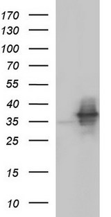 NFKBIA / IKB Alpha / IKBA Antibody - HEK293T cells were transfected with the pCMV6-ENTRY control (Left lane) or pCMV6-ENTRY NFKBIA (Right lane) cDNA for 48 hrs and lysed. Equivalent amounts of cell lysates (5 ug per lane) were separated by SDS-PAGE and immunoblotted with anti-NFKBIA.