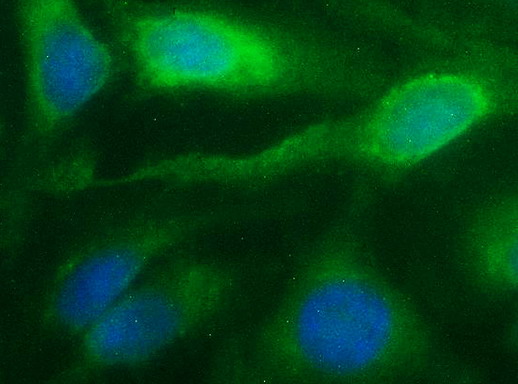 NFKBIA / IKB Alpha / IKBA Antibody - Immunofluorescent staining of HeLa cells using anti-NFKBIA mouse monoclonal antibody.