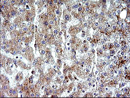 NFKBIA / IKB Alpha / IKBA Antibody - IHC of paraffin-embedded Human liver tissue using anti-NFKBIA mouse monoclonal antibody. (Heat-induced epitope retrieval by 10mM citric buffer, pH6.0, 120°C for 3min).