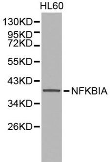 NFKBIA / IKB Alpha / IKBA Antibody - Western blot of NFKBIA pAb in extracts from HL60 cells.