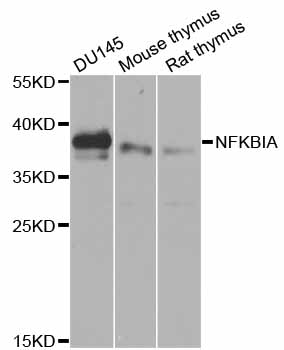 NFKBIA / IKB Alpha / IKBA Antibody - Western blot analysis of extracts of various cell lines, using NFKBIA antibody at 1:1000 dilution. The secondary antibody used was an HRP Goat Anti-Rabbit IgG (H+L) at 1:10000 dilution. Lysates were loaded 25ug per lane and 3% nonfat dry milk in TBST was used for blocking. An ECL Kit was used for detection and the exposure time was 3s.