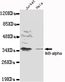 NFKBIA / IKB Alpha / IKBA Antibody - Western blot detection of IkB-alpha(N-terminus) in Jurkat and HeLa cell lysates using IkB-alpha(N-terminus) mouse monoclonal antibody (1:1000 dilution). Predicted band size: 36KDa. Observed band size: 36KDa.
