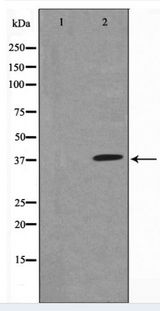 NFKBIA / IKB Alpha / IKBA Antibody - Western blot of IkappaB-alpha expression in TNF- alpha treated MCF7 whole cell lysates,The lane on the left is treated with the antigen-specific peptide.