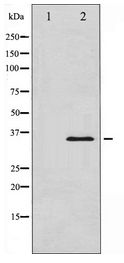 NFKBIA / IKB Alpha / IKBA Antibody - Western blot of IkappaB-alpha expression in HUVEC whole cell lysates,The lane on the left is treated with the antigen-specific peptide.
