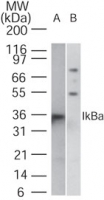 NFKBIA / IKB Alpha / IKBA Antibody - Western blot of IkBa in A) Daudi and B) 3T3 using antibody at 1 ug/ml. No cross-reacting is seen with the mouse cell line.