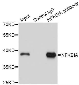 NFKBIA / IKB Alpha / IKBA Antibody - Immunoprecipitation analysis of 150ug extracts of A549 cells using 3ug NFKBIA antibody. Western blot was performed from the immunoprecipitate using NFKBIA antibody at a dilition of 1:500.