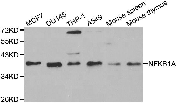 NFKBIA / IKB Alpha / IKBA Antibody - Western blot analysis of extracts of various cell lines, using NFKBIA antibody at 1:1000 dilution. The secondary antibody used was an HRP Goat Anti-Rabbit IgG (H+L) at 1:10000 dilution. Lysates were loaded 25ug per lane and 3% nonfat dry milk in TBST was used for blocking.