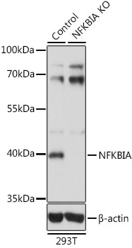 NFKBIA / IKB Alpha / IKBA Antibody - Western blot analysis of extracts from normal (control) and NFKBIA knockout (KO) 293T cells, using NFKBIA antibody at 1:1000 dilution. The secondary antibody used was an HRP Goat Anti-Rabbit IgG (H+L) at 1:10000 dilution. Lysates were loaded 25ug per lane and 3% nonfat dry milk in TBST was used for blocking. An ECL Kit was used for detection and the exposure time was 3s.