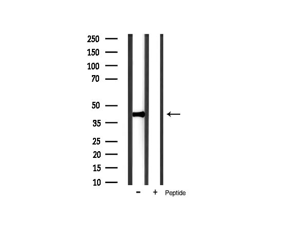 NFKBIA / IKB Alpha / IKBA Antibody - Western blot analysis of IkappaB-alpha expression in mouse muscle tissue lysates. The lane on the right is treated with the antigen-specific peptide.