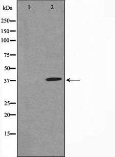 NFKBIA / IKB Alpha / IKBA Antibody - Western blot analysis of IkappaB-alpha expression in TNF-a treated MCF-7 whole cells lysates. The lane on the left is treated with the antigen-specific peptide.