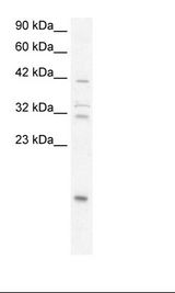 NFKBIA / IKB Alpha / IKBA Antibody - Fetal Lung Lysate.  This image was taken for the unconjugated form of this product. Other forms have not been tested.