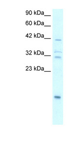 NFKBIA / IKB Alpha / IKBA Antibody - NFKBIA antibody Western blot of Lung lysate. This image was taken for the unconjugated form of this product. Other forms have not been tested.
