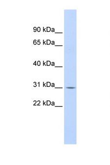 NFKBIA / IKB Alpha / IKBA Antibody - NFKBIA antibody Western blot of Fetal Liver lysate. Antibody concentration 1 ug/ml. This image was taken for the unconjugated form of this product. Other forms have not been tested.