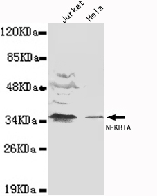 NFKBIA / IKB Alpha / IKBA Antibody - NFKBIA(N-terminus) antibody at 1/1000 dilution Lane1:Jurkat cell lysate 40 ug/Lane Lane2: HeLa cell lysate 40 ug/Lane.