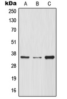 NFKBIA / IKB Alpha / IKBA Antibody - Western blot analysis of IKB alpha expression in THP1 (A); HeLa (B); Raw264.7 (C) whole cell lysates.
