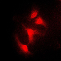 NFKBIA / IKB Alpha / IKBA Antibody - Immunofluorescent analysis of IKB alpha staining in HeLa cells. Formalin-fixed cells were permeabilized with 0.1% Triton X-100 in TBS for 5-10 minutes and blocked with 3% BSA-PBS for 30 minutes at room temperature. Cells were probed with the primary antibody in 3% BSA-PBS and incubated overnight at 4 C in a humidified chamber. Cells were washed with PBST and incubated with a DyLight 594-conjugated secondary antibody (red) in PBS at room temperature in the dark. DAPI was used to stain the cell nuclei (blue).