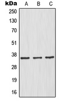 NFKBIA / IKB Alpha / IKBA Antibody - Western blot analysis of IKB alpha expression in HeLa (A); HepG2 (B); Raw264.7 (C) whole cell lysates.