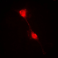 NFKBIA / IKB Alpha / IKBA Antibody - Immunofluorescent analysis of IKB alpha staining in HepG2 cells. Formalin-fixed cells were permeabilized with 0.1% Triton X-100 in TBS for 5-10 minutes and blocked with 3% BSA-PBS for 30 minutes at room temperature. Cells were probed with the primary antibody in 3% BSA-PBS and incubated overnight at 4 C in a humidified chamber. Cells were washed with PBST and incubated with a DyLight 594-conjugated secondary antibody (red) in PBS at room temperature in the dark. DAPI was used to stain the cell nuclei (blue).