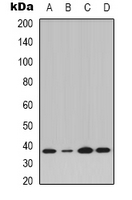 NFKBIA / IKB Alpha / IKBA Antibody - Western blot analysis of IKB alpha (pY42) expression in K562 (A); Jurkat IL1b-treated (B); Raw264.7 LPS-treated (C); H9C2 LPS-treated (D) whole cell lysates.