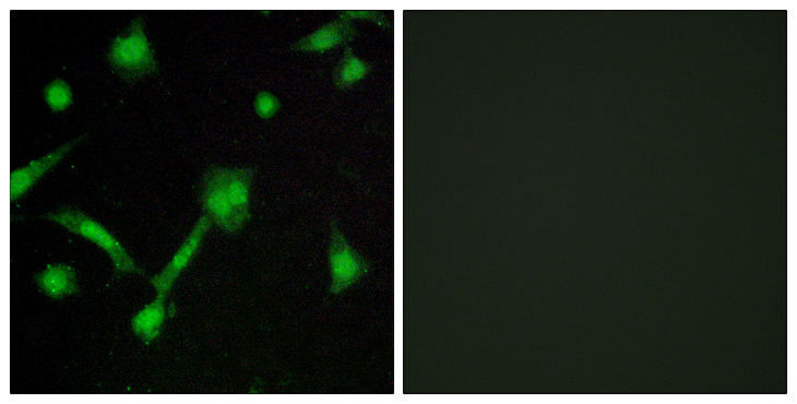 NFKBIA / IKB Alpha / IKBA Antibody - Immunofluorescence analysis of LOVO cells, using IkappaB-alpha (Phospho-Ser32/Ser36) Antibody. The picture on the right is blocked with the phospho peptide.