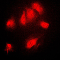 NFKBIA / IKB Alpha / IKBA Antibody - Immunofluorescent analysis of IKB alpha (pS32/S36) staining in Raw264.7 cells. Formalin-fixed cells were permeabilized with 0.1% Triton X-100 in TBS for 5-10 minutes and blocked with 3% BSA-PBS for 30 minutes at room temperature. Cells were probed with the primary antibody in 3% BSA-PBS and incubated overnight at 4 C in a humidified chamber. Cells were washed with PBST and incubated with a DyLight 594-conjugated secondary antibody (red) in PBS at room temperature in the dark. DAPI was used to stain the cell nuclei (blue).