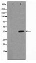 NFKBIA / IKB Alpha / IKBA Antibody - Western blot of I kappaB- alpha phosphorylation expression in COS7 whole cell lysates,The lane on the left is treated with the antigen-specific peptide.