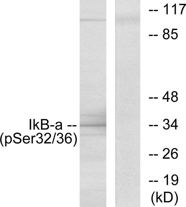 NFKBIA / IKB Alpha / IKBA Antibody - Western blot analysis of extracts from COS-7 cells, using I?B-a (Phospho-Ser32/Ser36) antibody.
