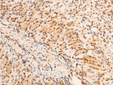 NFKBIA / IKB Alpha / IKBA Antibody - 1:100 staining mouse gastric tissue by IHC-P. The tissue was formaldehyde fixed and a heat mediated antigen retrieval step in citrate buffer was performed. The tissue was then blocked and incubated with the antibody for 1.5 hours at 22°C. An HRP conjugated goat anti-rabbit antibody was used as the secondary.
