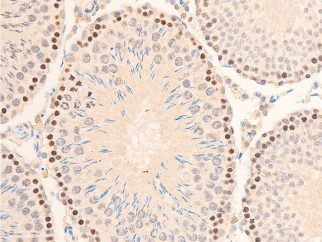 NFKBIA / IKB Alpha / IKBA Antibody - 1:100 staining mouse testis tissue by IHC-P. The tissue was formaldehyde fixed and a heat mediated antigen retrieval step in citrate buffer was performed. The tissue was then blocked and incubated with the antibody for 1.5 hours at 22°C. An HRP conjugated goat anti-rabbit antibody was used as the secondary.