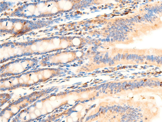 NFKBIA / IKB Alpha / IKBA Antibody - 1:100 staining mouse intestinal tissue by IHC-P. The tissue was formaldehyde fixed and a heat mediated antigen retrieval step in citrate buffer was performed. The tissue was then blocked and incubated with the antibody for 1.5 hours at 22°C. An HRP conjugated goat anti-rabbit antibody was used as the secondary.