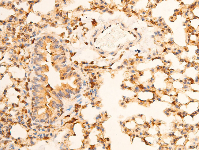 NFKBIA / IKB Alpha / IKBA Antibody - 1:100 staining mouse lung tissue by IHC-P. The tissue was formaldehyde fixed and a heat mediated antigen retrieval step in citrate buffer was performed. The tissue was then blocked and incubated with the antibody for 1.5 hours at 22°C. An HRP conjugated goat anti-rabbit antibody was used as the secondary.