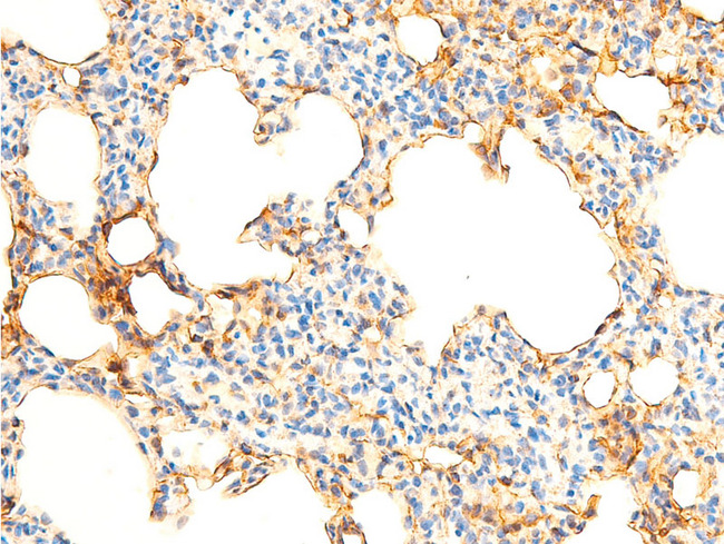 NFKBIA / IKB Alpha / IKBA Antibody - 1:100 staining rat lung tissue by IHC-P. The tissue was formaldehyde fixed and a heat mediated antigen retrieval step in citrate buffer was performed. The tissue was then blocked and incubated with the antibody for 1.5 hours at 22°C. An HRP conjugated goat anti-rabbit antibody was used as the secondary.