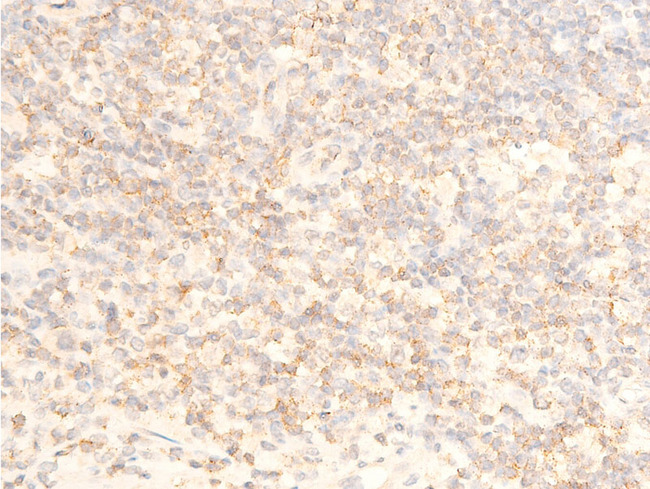 NFKBIA / IKB Alpha / IKBA Antibody - 1:100 staining human appendix tissue by IHC-P. The tissue was formaldehyde fixed and a heat mediated antigen retrieval step in citrate buffer was performed. The tissue was then blocked and incubated with the antibody for 1.5 hours at 22°C. An HRP conjugated goat anti-rabbit antibody was used as the secondary.