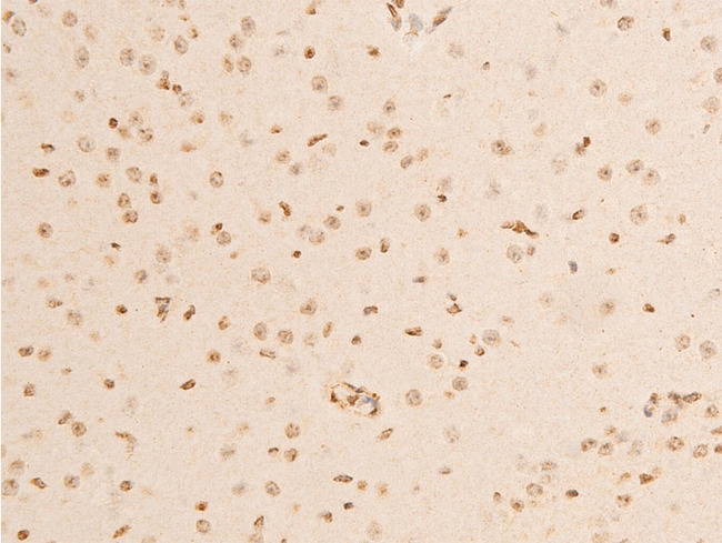 NFKBIA / IKB Alpha / IKBA Antibody - 1:100 staining mouse brain tissue by IHC-P. The tissue was formaldehyde fixed and a heat mediated antigen retrieval step in citrate buffer was performed. The tissue was then blocked and incubated with the antibody for 1.5 hours at 22°C. An HRP conjugated goat anti-rabbit antibody was used as the secondary.