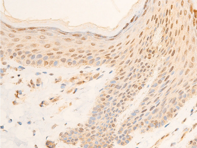 NFKBIA / IKB Alpha / IKBA Antibody - 1:100 staining human skin tissue by IHC-P. The tissue was formaldehyde fixed and a heat mediated antigen retrieval step in citrate buffer was performed. The tissue was then blocked and incubated with the antibody for 1.5 hours at 22°C. An HRP conjugated goat anti-rabbit antibody was used as the secondary.